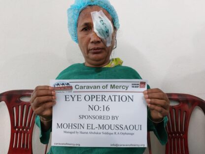 Eye Operations Bangladesh - Image 5